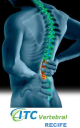 itc vertebral